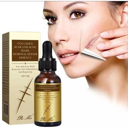 TCM Scar & Acne Mark Removal Repair Essence 30g