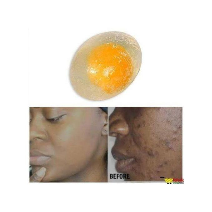 Egg Soap Egg Yolk Collagen Facial Soap For Sun Burn, Acne, Dark Spots
